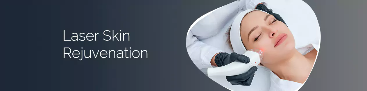 Acne Treatment in Delhi